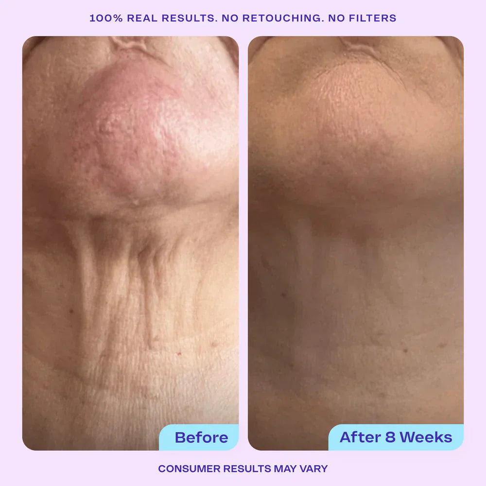 Why Does Skin Lose Firmness After 30? A Complete Guide for Women