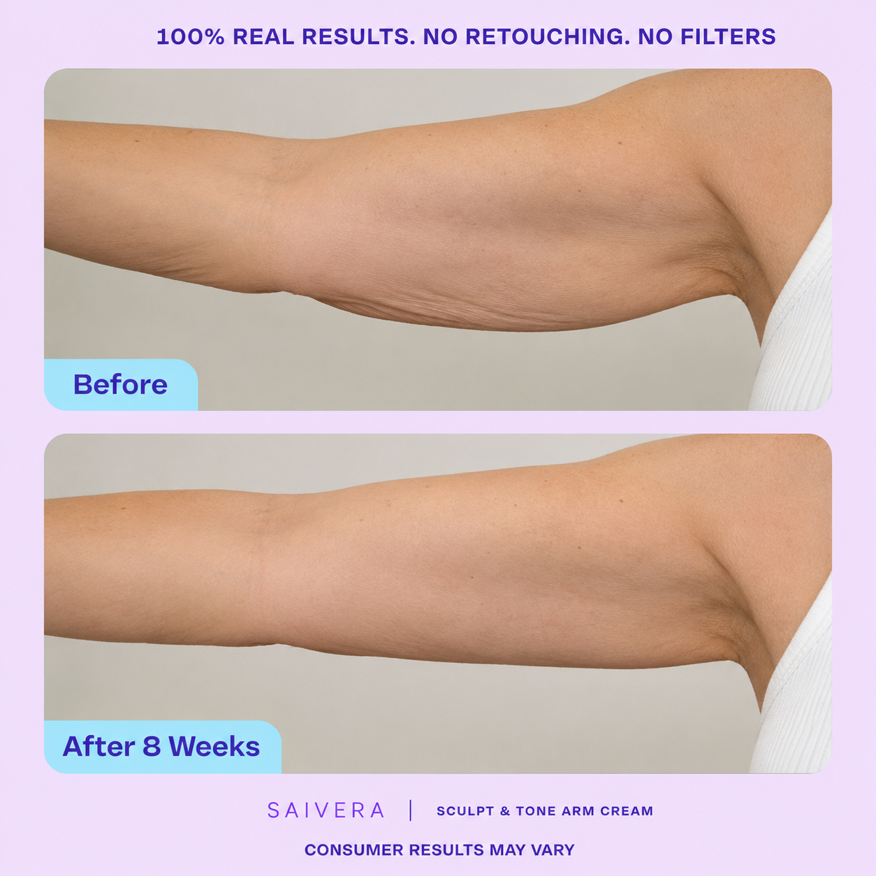 How to Improve the Appearance of Loose Arm Skin: A Complete Guide