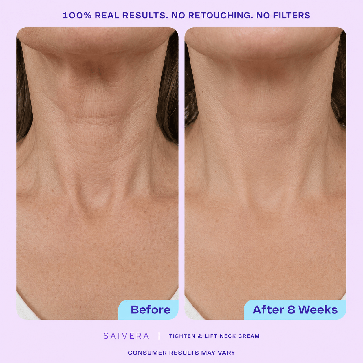 Loose Neck Skin After 40: Causes, Prevention, and Daily Care Tips - SAIVERA