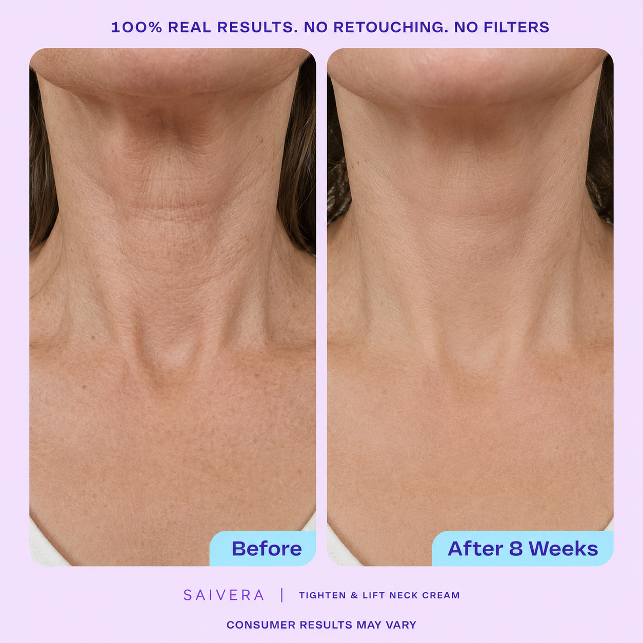 Loose Neck Skin After 40: Causes, Prevention, and Daily Care Tips